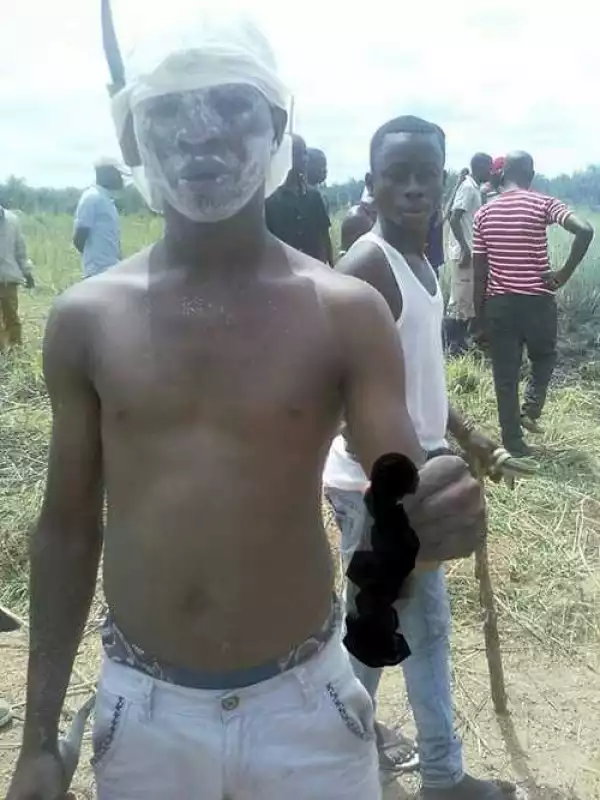 Angry Youths Cut Off the P*nis of a Suspected R*pist in Niger State (Photos)